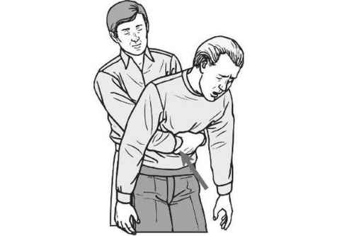 fameuse_manoeuvre_heimlich